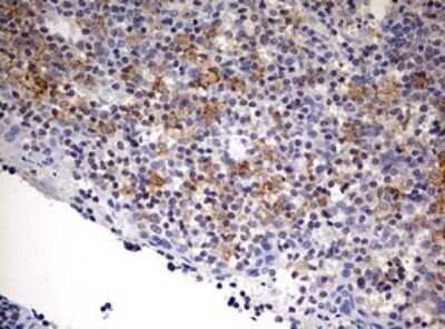 Immunohistochemistry: SPATA2L Antibody (OTI3F6) [NBP2-45940]