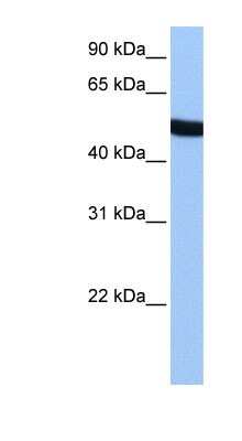 Western Blot: SPATA6 Antibody [NBP1-70710]