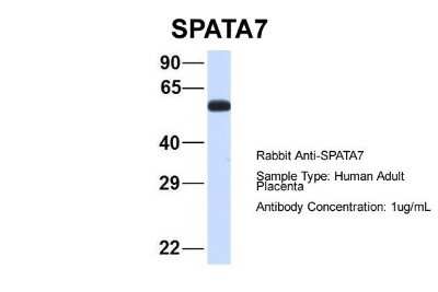Western Blot: SPATA7 Antibody [NBP1-56884]