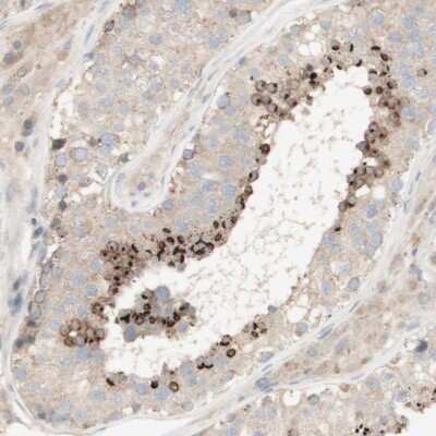 Immunohistochemistry-Paraffin: SPATA9 Antibody [NBP1-83493]