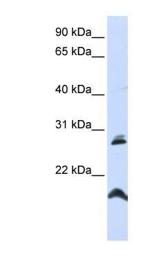 Western Blot: SPATA9 Antibody [NBP1-59460]