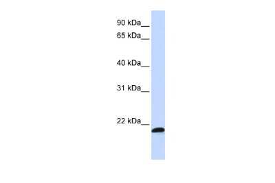 Western Blot: SPATC1L Antibody [NBP3-10591]