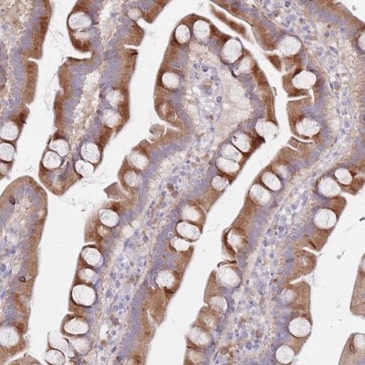 Immunohistochemistry-Paraffin: SPATS1 Antibody [NBP2-31037]