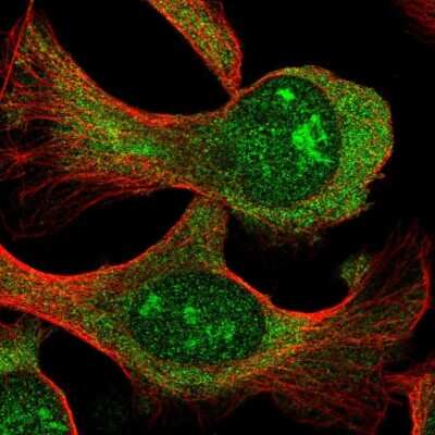 Immunocytochemistry/ Immunofluorescence: SPATS2L Antibody [NBP2-31605]