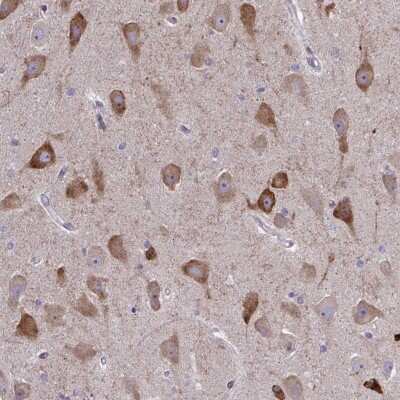 Immunohistochemistry: SPATS2L Antibody [NBP2-31605]