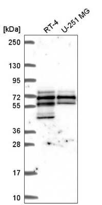 Western Blot: SPATS2L Antibody [NBP2-55840]