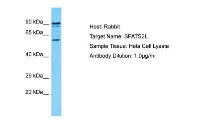 Western Blot: SPATS2L Antibody [NBP2-85806]