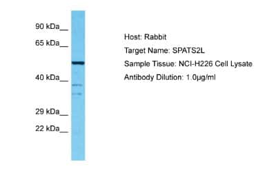 Western Blot: SPATS2L Antibody [NBP2-85807]