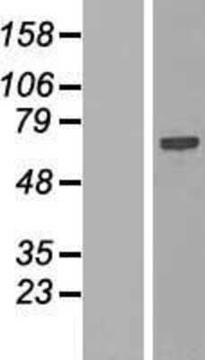 Western Blot: SPATS2L Overexpression Lysate [NBP2-08255]