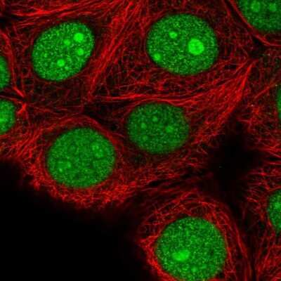 Immunocytochemistry/ Immunofluorescence: SPC24 Antibody [NBP2-47264]