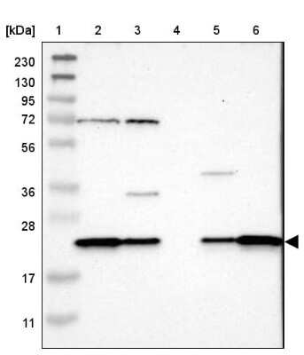 Western Blot: SPCS2 Antibody [NBP1-93656]