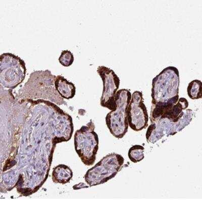 Immunohistochemistry: SPCS3 Antibody [NBP2-30420]