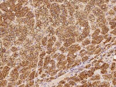 Immunohistochemistry-Paraffin: SPDYC Antibody [NBP2-98160]