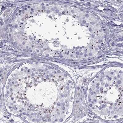 Immunohistochemistry-Paraffin: SPDYE1 Antibody [NBP2-46794]