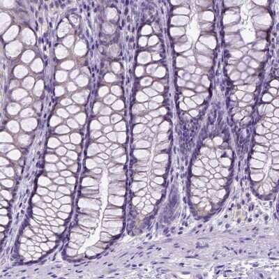 Immunohistochemistry-Paraffin: SPEF1 Antibody [NBP2-14707]
