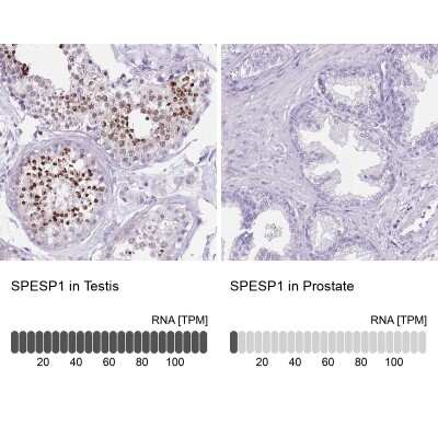 Immunohistochemistry-Paraffin: SPESP1 Antibody [NBP2-13370]