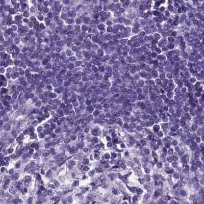 Immunohistochemistry-Paraffin: SPESP1 Antibody [NBP2-13370]