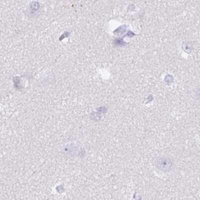 Immunohistochemistry-Paraffin: SPESP1 Antibody [NBP2-48994]