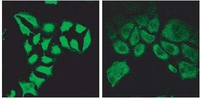 Immunocytochemistry/ Immunofluorescence: SPG20 Antibody [NBP1-47203]