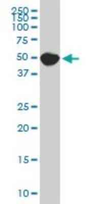 Western Blot: SPG3A Antibody (1B11) [H00051062-M10]