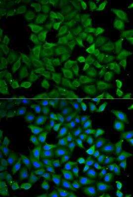 Immunocytochemistry/ Immunofluorescence: SPG3A Antibody - BSA Free [NBP2-93512]