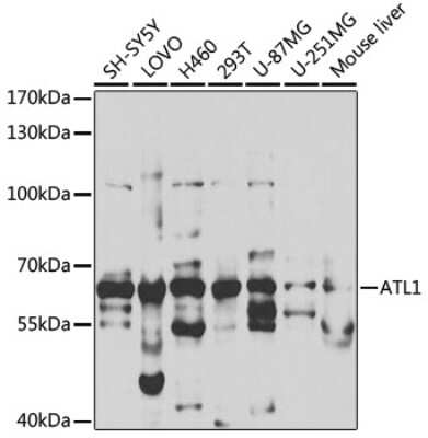 Western Blot: SPG3A AntibodyBSA Free [NBP2-93512]