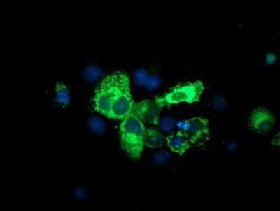 Immunocytochemistry/ Immunofluorescence: SPG7 Antibody (OTI1C1) - Azide and BSA Free [NBP2-74327]