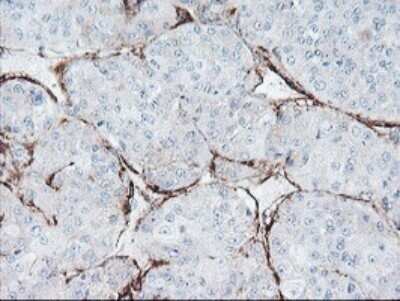 Immunohistochemistry: SPG7 Antibody (OTI1G4) - Azide and BSA Free [NBP2-74323]
