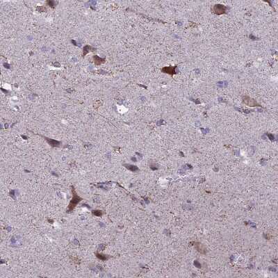 Immunohistochemistry-Paraffin: SPHKAP Antibody [NBP2-30770]