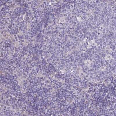 Immunohistochemistry-Paraffin: SPHKAP Antibody [NBP2-30770]