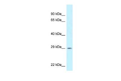 Western Blot: SPIC Antibody [NBP2-84277]