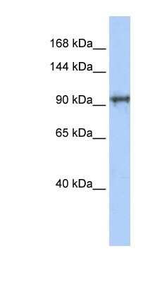 Western Blot: SPICE1 Antibody [NBP1-70711]