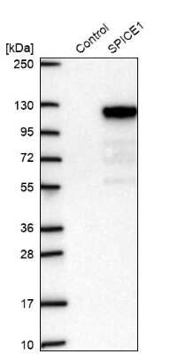 Western Blot: SPICE1 Antibody [NBP2-39035]