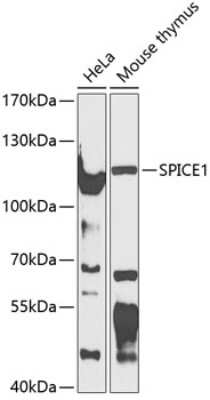 Western Blot: SPICE1 AntibodyBSA Free [NBP2-93121]