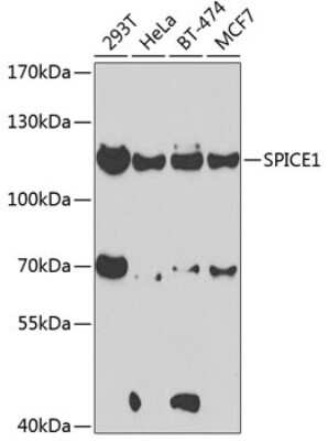 Western Blot: SPICE1 AntibodyBSA Free [NBP2-94516]