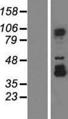 Western Blot: SPICE1 Overexpression Lysate [NBP2-05531]