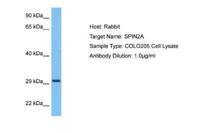 Western Blot: SPIN2A Antibody [NBP2-83592]