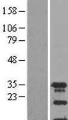 Western Blot: SPIN2A Overexpression Lysate [NBL1-16402]
