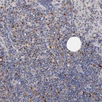 Immunohistochemistry-Paraffin: SPINDOC Antibody [NBP1-81298]