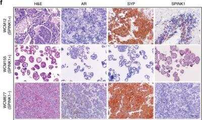 Immunohistochemistry: SPINK1 Antibody (4D4) [H00006690-M01]