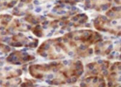 Immunohistochemistry-Paraffin: SPINK1 Antibody (4D4) [H00006690-M01]