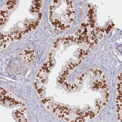 Immunohistochemistry-Paraffin: SPINK13 Antibody [NBP1-93701]