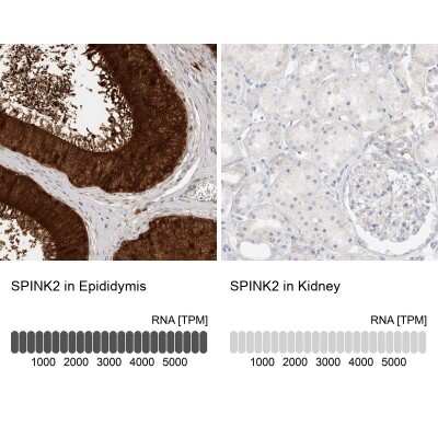 Immunohistochemistry-Paraffin: SPINK2 Antibody [NBP1-83133]