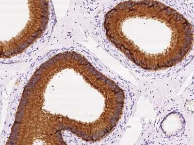 Immunohistochemistry-Paraffin: SPINK2 Antibody [NBP2-98568]
