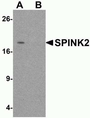 Western Blot: SPINK2 AntibodyBSA Free [NBP2-82015]
