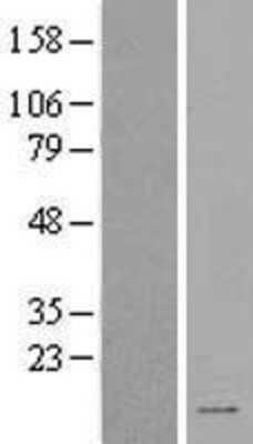 Western Blot: SPINK2 Overexpression Lysate [NBL1-16406]