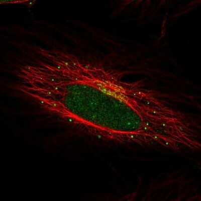 Immunocytochemistry/ Immunofluorescence: SPINK4 Antibody [NBP1-93519]