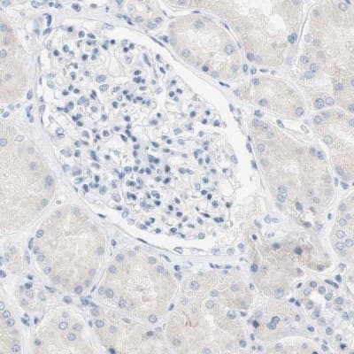 Immunohistochemistry-Paraffin: SPINK5 Antibody [NBP1-90509]