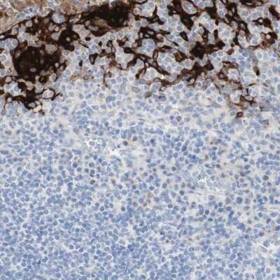 Immunohistochemistry-Paraffin: SPINK5 Antibody [NBP1-90509]