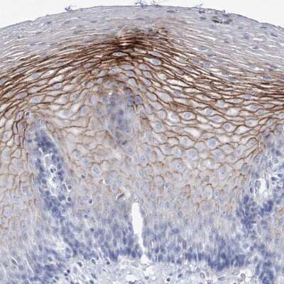 Immunohistochemistry-Paraffin: SPINK7 Antibody [NBP1-84015]